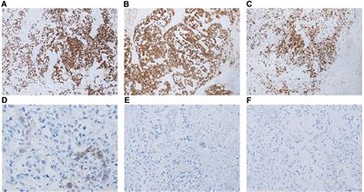 Preservation of sexual and reproductive function in the treatment of extragonadal yolk sac tumors in the female genital tract